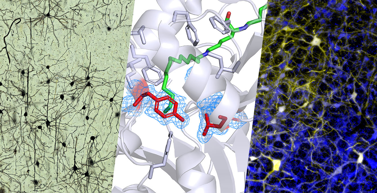 5. Structural analysis of protein-drug interactions