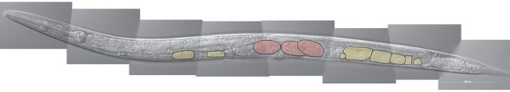 2. DIC image of C. elegans with oocyes and eggs colored